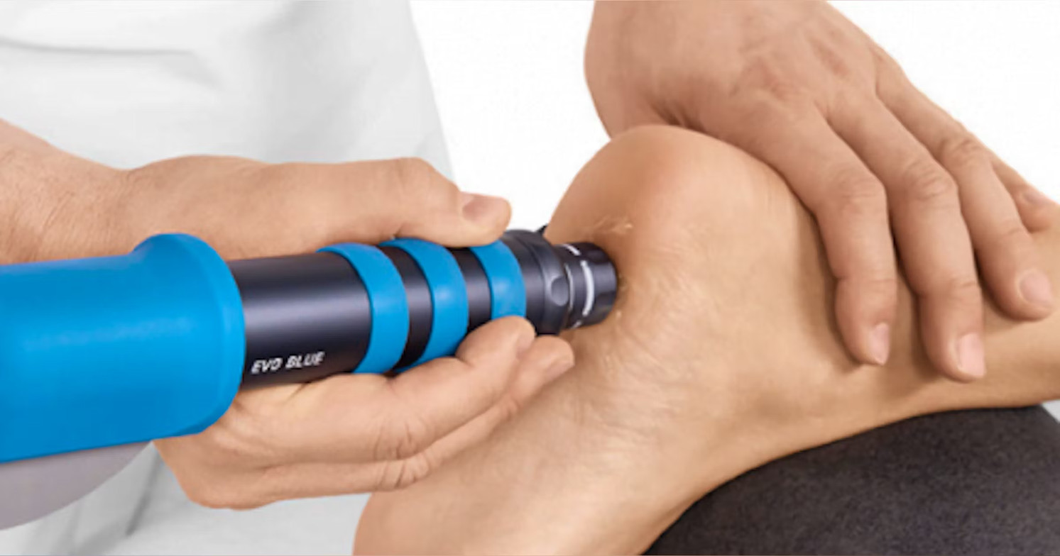 Radial shockwave therapy being applied to the heel as part of plantar fasciitis treatment.