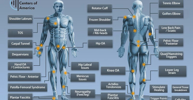 Types of Shockwave Therapy: What’s the Difference and Which Is Right for You?