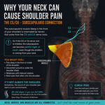 Diagram showing how C5 and C6 nerve irritation can cause shoulder and subscapularis pain