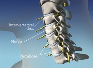 Cervical spine anatomy showing vertebrae, discs, and spinal nerves.