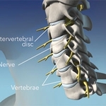 Cervical spine anatomy showing vertebrae, discs, and spinal nerves.