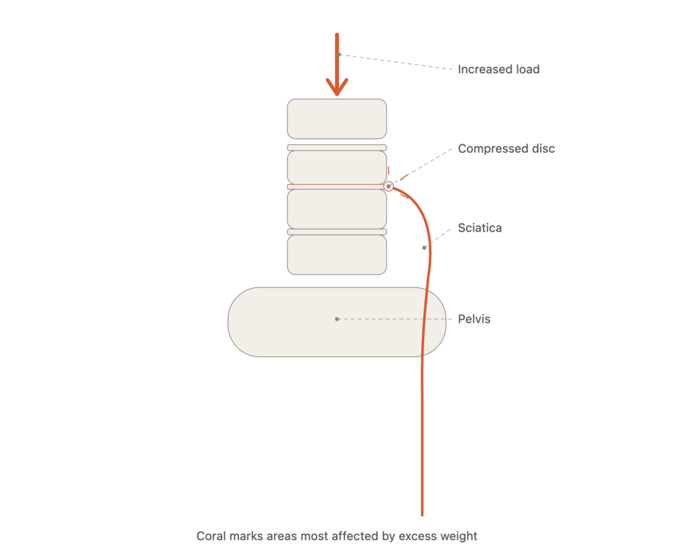 weight_loss_spine_nerve_impact